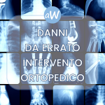 Avvocati per Risarcimento da Malasanità Ortopedica