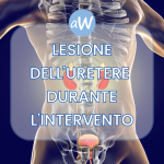 Lesione dell’uretere per colpa medica e risarcimento