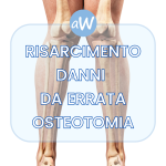 Risarcimento da errata osteotomia