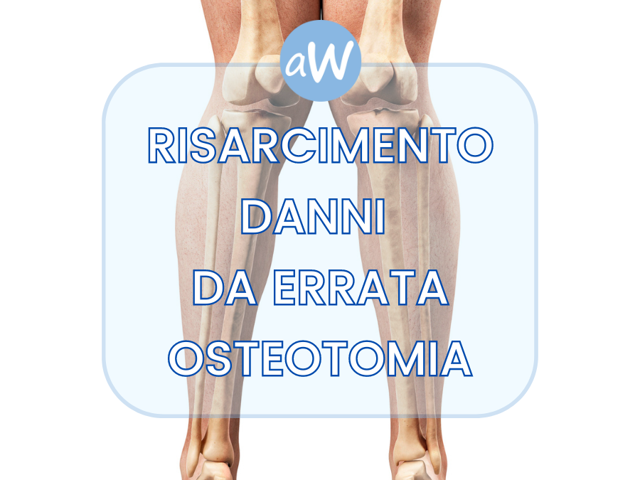 Risarcimento da errata osteotomia