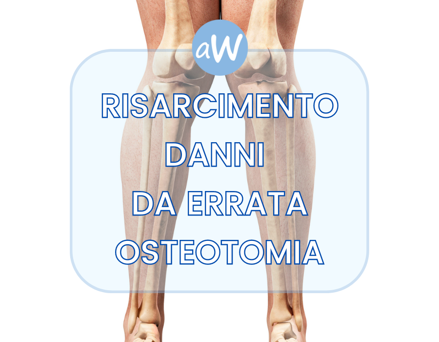 Risarcimento da errata osteotomia