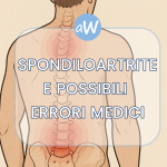 Spondiloartrite e Risarcimento per Malasanità da Errori Medici
