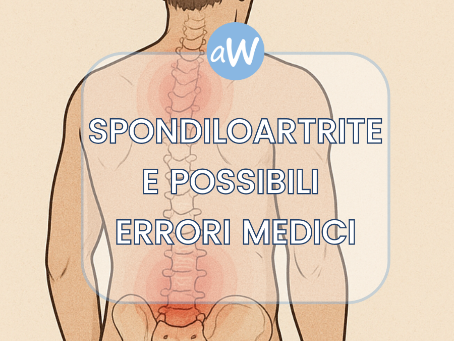 Spondiloartrite e Risarcimento per Malasanità da Errori Medici