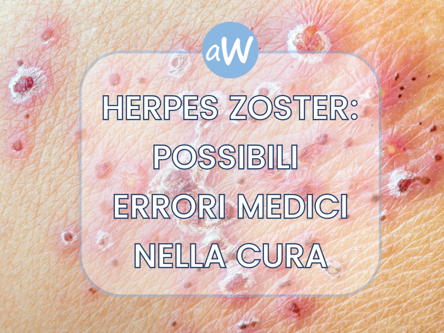 Herpes Zoster: possibili Errori Medici e Risarcimento