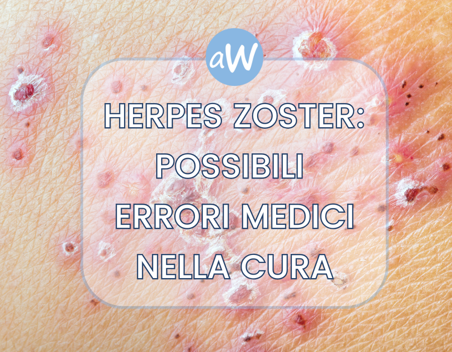 Herpes Zoster: possibili Errori Medici e Risarcimento