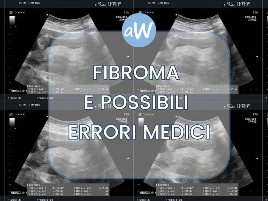 Fibroma a Utero o Seno e casi di Malasanità: come ottenere il Risarcimento