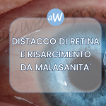 Distacco di Retina: Cosa Fare in Caso di Malasanità