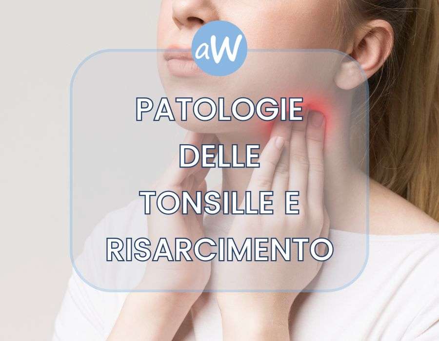 Malasanità nella cura di Patologie delle Tonsille e Risarcimento